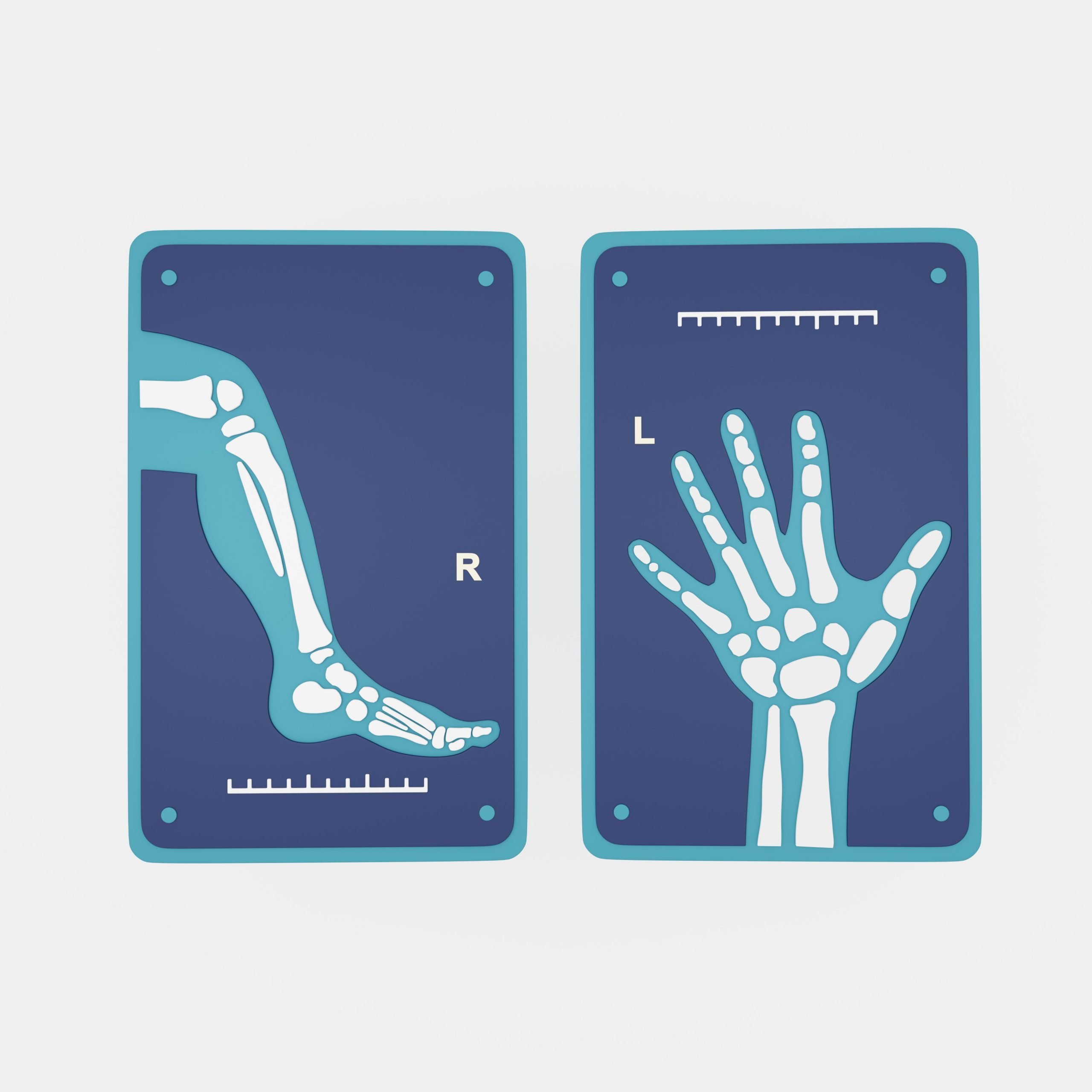 Illustration of two X-rays: one showing a right leg and foot labeled R, and the other showing a left hand labeled L. Both X-rays are on a blue background with measurement scales.
